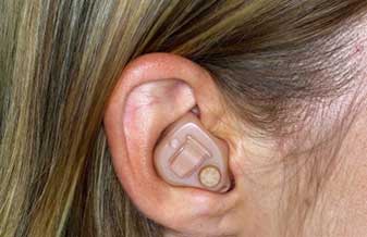 Centro Auditivo Telex - Foto 1