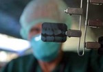 radiografia-odontologia-em-osasco-1431027089